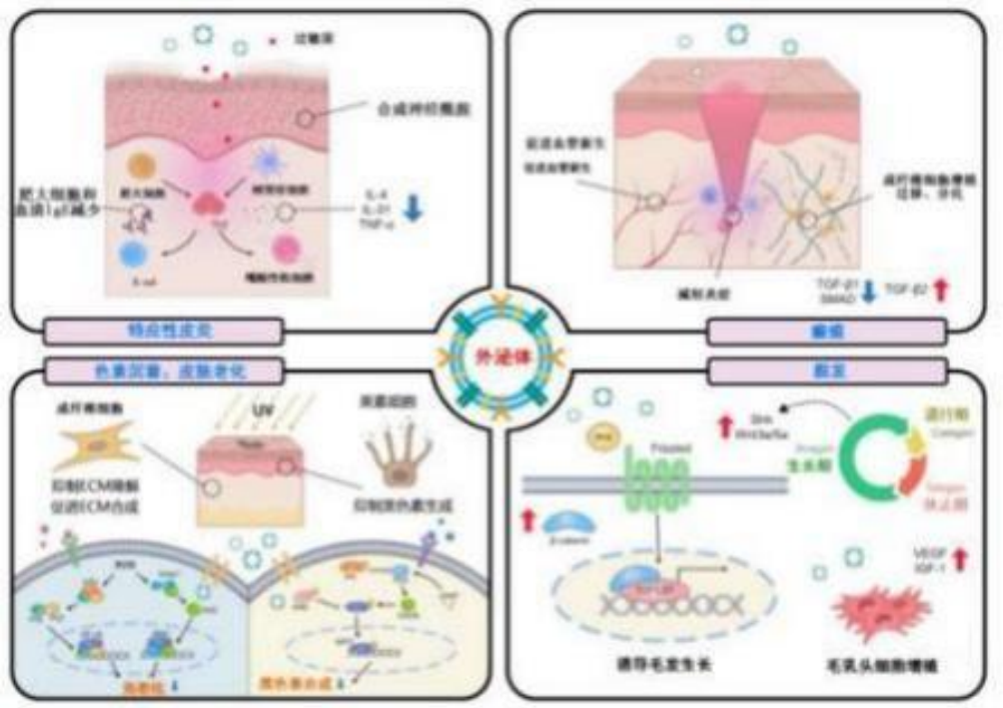  皮肤修复及抗衰——外泌体面部抗衰